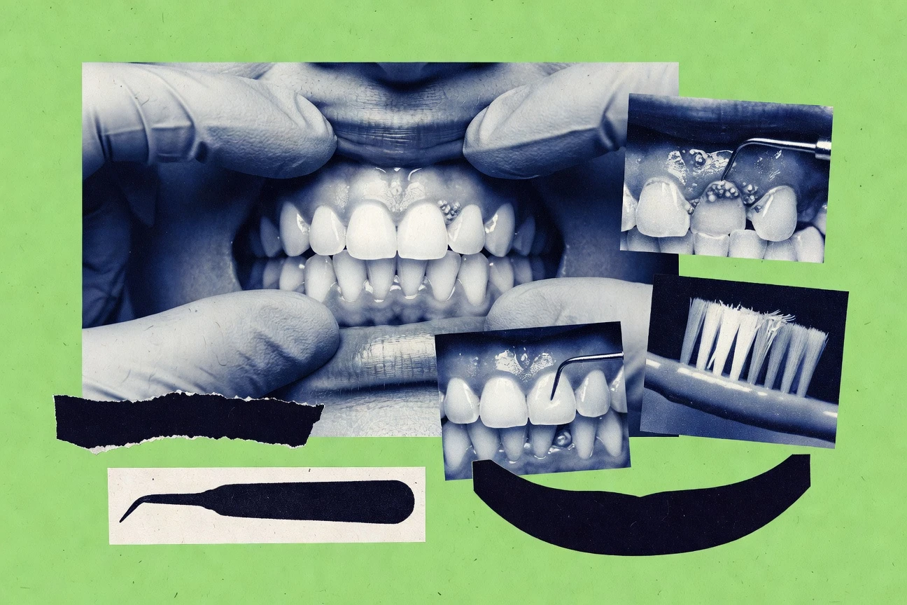 40+ Gum Disease Statistics (2026, Verified)